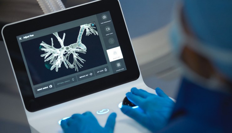 برونکوسکوپی؛ روش پزشکی بررسی ریه و مجاری تنفسی 18 برونکوسکوپی ریه روشی برای تشخیص مشکلات ریوی و مجاری تنفسی