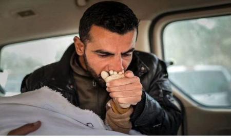 دردناک ترین تصویری که این روزها دیده شد+عکس