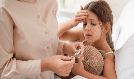 رژیم غذایی مناسب برای مبتلایان به آبله مرغان 2 رژیم غذایی مناسب برای مبتلایان به آبله مرغان