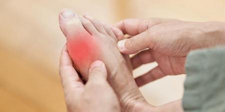 داروی سرطان به کمک درمان بیماری نقرس می‌آید