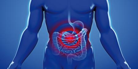 علت ابتلا به سرطان روده بزرگ چیست؟ 3 علت ابتلا به سرطان روده بزرگ چیست؟