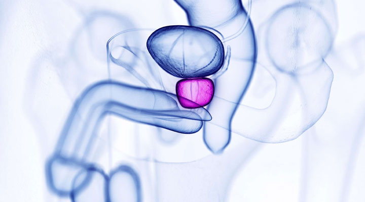 ماساژ پروستات؛ مزایا و عوارض احتمالی + روش انجام ماساژ 2 ماساژ پروستات برای تحریک جنسی