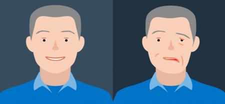 در فلج بل چه اتفاقی می‌افتد؟ + اینفوگرافیک