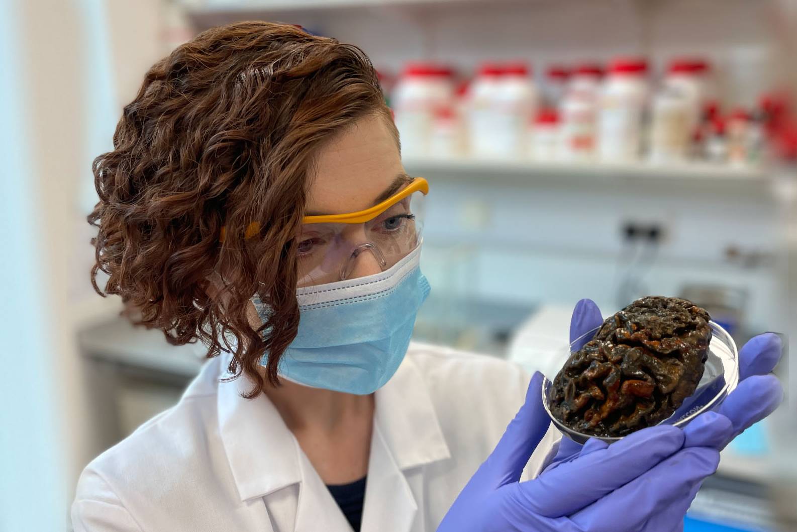 مغزهای باستانی ۱۲هزار ساله چگونه هنوز نپوسیده‌اند؟