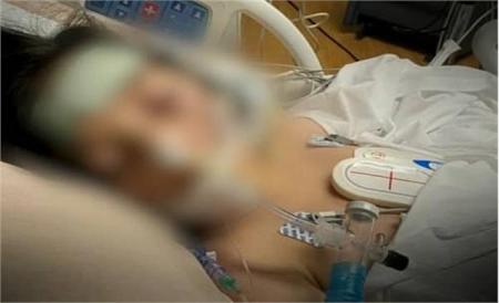 تصاویر تلخی از کودک مجروح‌شده در حملات تروریستی گروهک جیش‌الظلم