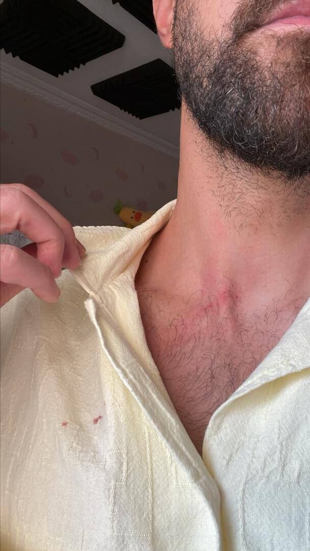 دعوا سارقان به مهاجم اسبق استقلال در اتوبان چمران تهران + عکس_سودو تکنولوژی 6 حمله سارقان به مهاجم سابق استقلال در اتوبان چمران تهران + عکس