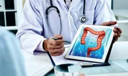 علائم روده بزرگ را بشناسیم_سودو تکنولوژی 3 علائم روده بزرگ را بشناسیم