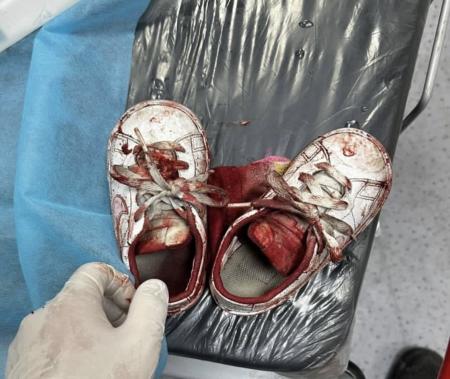 کفش‌هایی که با دیدن آن‌ها خون به دلتان می‌شود+عکس