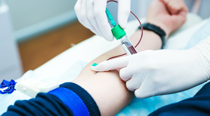 الیگومنوره؛ آنچه باید درمورد قاعدگی نامنظم بدانید_سودو تکنولوژی 4 الیگومنوره - آزمایشهای مربوط به الیگومنوره