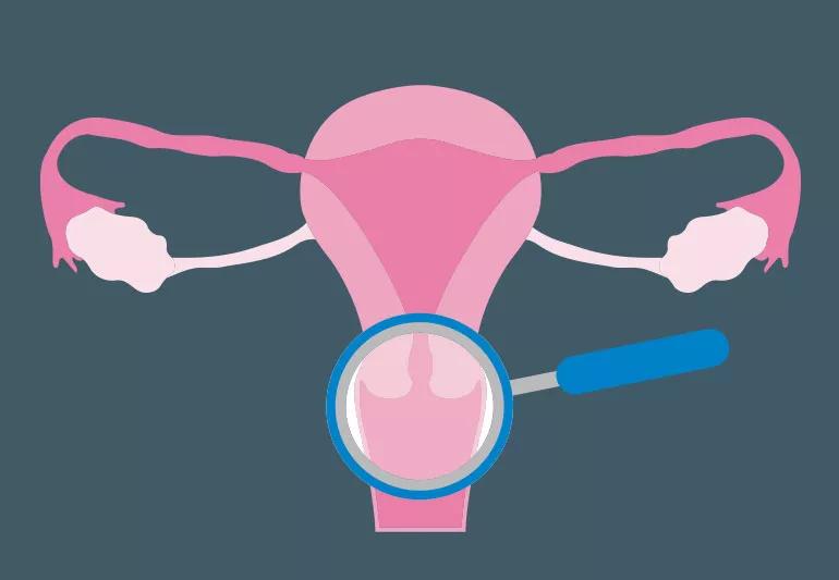 هزینههای تست پاپ اسمیر | بهداشت نیوز_سودو تکنولوژی 2 What to Expect After an Abnormal Pap Smear