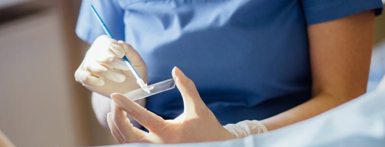 هزینههای تست پاپ اسمیر | بهداشت نیوز_سودو تکنولوژی 3 Can You Get a Pap Smear on Your Period?