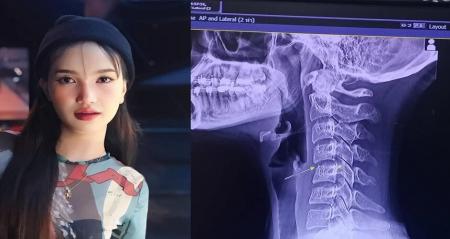 ماساژ گردن، جان خواننده جوان پاپ را گرفت+عکس_سودو تکنولوژی 1 ماساژ گردن، جان خواننده جوان پاپ را گرفت+عکس