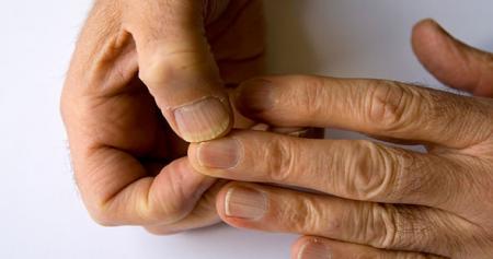 اسراری که ناخن‌ها فاش می‌کنند | بهداشت نیوز