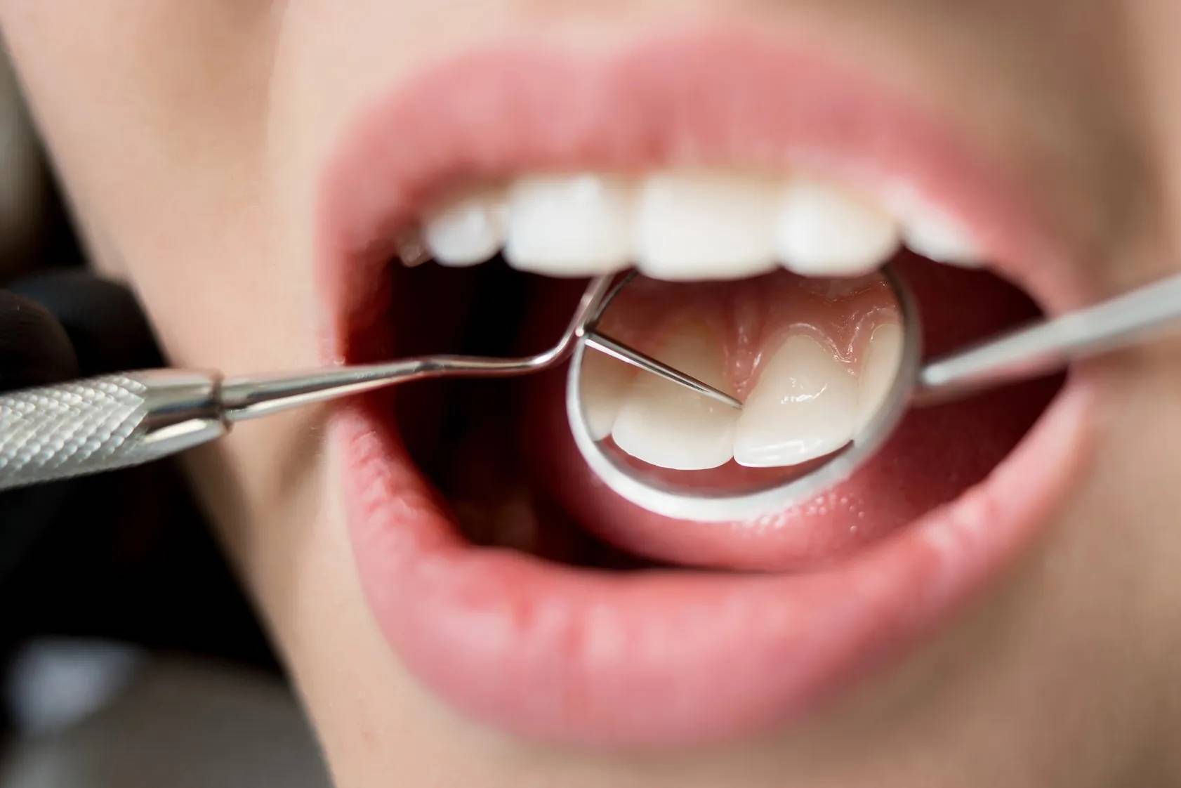 خداحافظ ایمپلنت؛ دندان رشدیافته در آزمایشگاه دندان‌پزشکی را متحول می‌کند